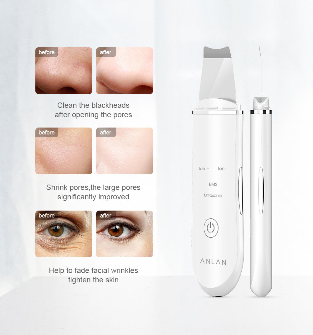 Skin Scrubber ANLAN® – Nettoyage en profondeur par ultrasons, Ion+, EMS